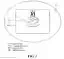 Fig. 02 - Process and device for treating blind regions of the visual field