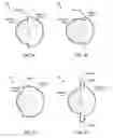 Fig. 03 - Retroreflective marker-tracking systems