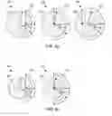 Fig. 04 - Retroreflective marker-tracking systems