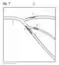 Fig. 06 - Method and CT system for detecting and differentiating plaque in vessel structures of a patient