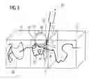 Fig. 04 - Method for graphically following a movement of a medical instrument introduced into an object under examination