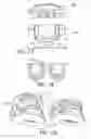 Fig. 08 - Apparatus and method for manufacturing a mandibular advancement device