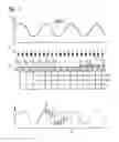 Fig. 06 - Focus/detector system of an X-ray apparatus for generating phase contrast recordings