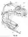 Fig. 16 - Headset terminal with rear stability strap