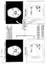 Fig. 04 - Face feature point detecting device and method