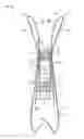 Fig. 01 - Reclosable pouch and zipper for a reclosable pouch