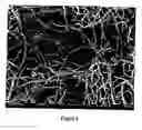 Fig. 06 - Carbon nanostructures and process for the production of carbon-based nanotubes, nanofibres and nanostructures