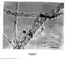 Fig. 07 - Carbon nanostructures and process for the production of carbon-based nanotubes, nanofibres and nanostructures