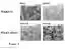 Fig. 09 - Methods, agents, and compound screening assays for inducing differentiation of undifferentiatied mammalian cells into osteoblasts
