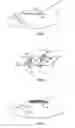 Fig. 02 - Tissue harvesting device and method