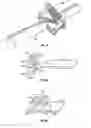 Fig. 04 - Tissue harvesting device and method
