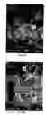 Fig. 09 - ARTIFICIAL STABILIZED COMPOSITION OF CALCIUM PHOSPHATE PHASES PARTICULARLY ADAPTED FOR SUPPORTING BONE CELL ACTIVITY