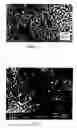 Fig. 12 - ARTIFICIAL STABILIZED COMPOSITION OF CALCIUM PHOSPHATE PHASES PARTICULARLY ADAPTED FOR SUPPORTING BONE CELL ACTIVITY