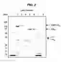 Fig. 03 - Re-targeted toxin conjugates