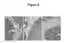 Fig. 12 - Method of using abscisic acid to treat diseases and disorders