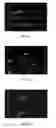Fig. 04 - Biomedical device having crosslinked biopolymer micro pattern and preparation thereof
