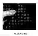 Fig. 16 - Polysaccharide compositions for use in tissue augmentation