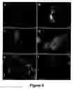 Fig. 08 - Adhesin-specific nanoparticles and process for using same