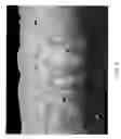 Fig. 08 - Method for forming thick quasi-single phase and single phase platinum nickel aluminide coatings
