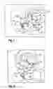 Fig. 04 - Orthodontic spring for treatment of an impacted molar
