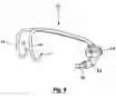 Fig. 05 - Orthodontic spring for treatment of an impacted molar