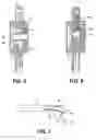 Fig. 04 - Caries detection using real-time imaging and multiple excitation frequencies