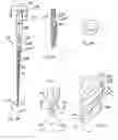 Fig. 05 - Precision cast dental instrument