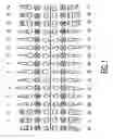 Fig. 02 - Method for producing a quantitative measure of dental health