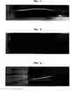 Fig. 05 - Pre-coated root canal filling point