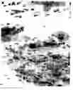 Fig. 06 - Automated microscopic sperm identification
