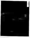 Fig. 16 - Automated microscopic sperm identification