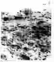 Fig. 29 - Automated microscopic sperm identification
