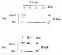 Fig. 01 - METHODS OF SCREENING APOPTOSIS MODULATING COMPOUNDS, COMPOUNDS IDENTIFIED BY SAID METHODS AND USE OF SAID COMPOUNDS AS THERAPEUTIC AGENTS