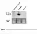 Fig. 03 - RNA probes