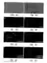 Fig. 05 - Method for detecting a host receptor for pathogenic bacteria