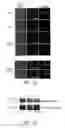 Fig. 10 - Method for detecting a host receptor for pathogenic bacteria