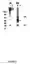 Fig. 13 - Functional influenza virus like particles (VLPs)