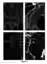 Fig. 08 - Method of inducing fenestrae