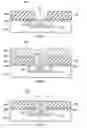 Fig. 04 - Method for removing residue containing an embedded metal