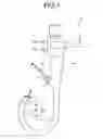 Fig. 02 - Endoscope plug body breakable in two stages