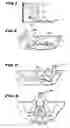 Fig. 04 - Physical therapy system