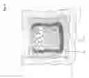 Fig. 05 - BONE CEMENT COMPOSITE CONTAINING PARTICLES IN A NON-UNIFORM SPATIAL DISTRIBUTION AND DEVICES FOR IMPLEMENTATION