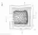 Fig. 06 - BONE CEMENT COMPOSITE CONTAINING PARTICLES IN A NON-UNIFORM SPATIAL DISTRIBUTION AND DEVICES FOR IMPLEMENTATION