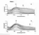 Fig. 09 - Novel albumins