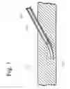 Fig. 02 - Treatment of pain, neurological dysfunction and neoplasms using radiation delivery catheters