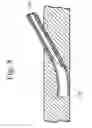Fig. 09 - Treatment of pain, neurological dysfunction and neoplasms using radiation delivery catheters