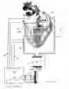 Fig. 02 - Cardiac assist device and method