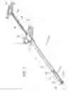 Fig. 02 - Gastric band introduction device