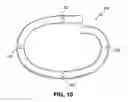 Fig. 07 - Two-way adjustable implant