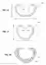 Fig. 11 - Two-way adjustable implant